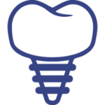 Prótese sobre implante