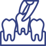 Extração dentária